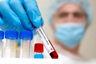 Ευλογιά των πιθήκων: Συναγερμός και στην Ευρώπη, στη Σουηδία το πρώτο κρούσμα εκτός Αφρικής