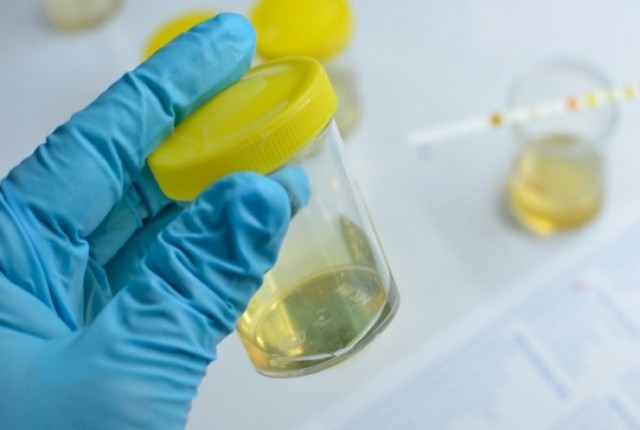 Ποια σοβαρή ασθένεια "προδίδει" η οσμή των ούρων;