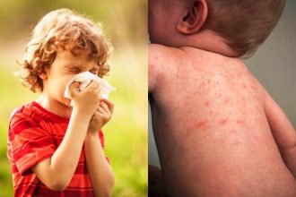 Παιδιά και αλλεργίες - Τα συμπτώματα και τί τις πυροδοτεί