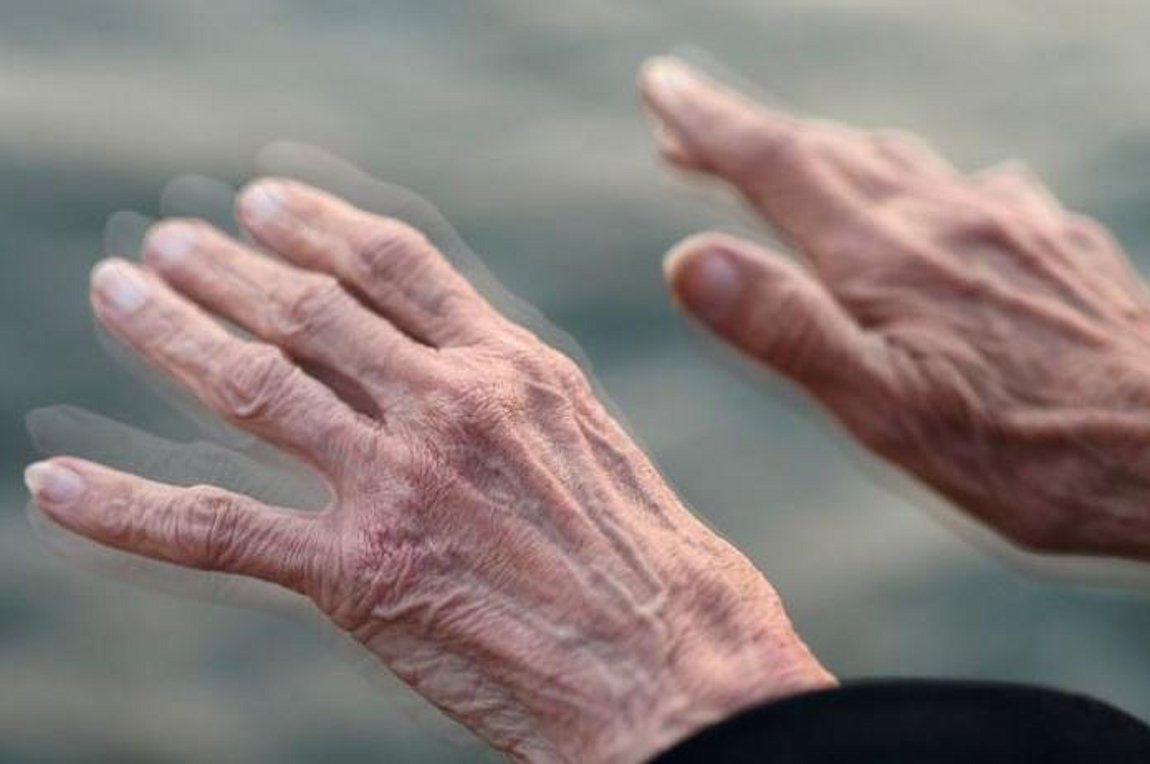 Φάρμακο για τον προστάτη μπορεί να επιβραδύνει το Πάρκινσον