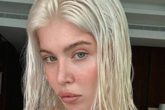 Οι τροφές που μπορούν να επιδεινώσουν την ακμή