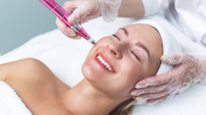 Microneedling: Γιατί πρέπει να το δοκιμάσετε