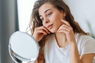 Τα do’s & don’ts για δέρμα με τάση ακμής