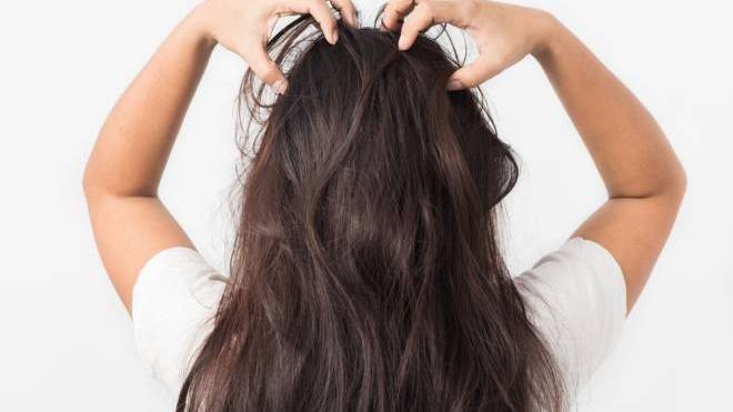 Έχετε ξηρό & ερεθισμένο τριχωτό του κεφαλιού; 4 τρόποι για να το ενυδατώσετε