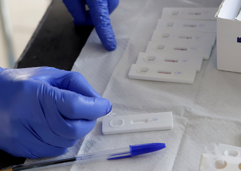 Δωρεάν rapid test σε Αχαΐα και Ηλεία, την Πέμπτη 6 Ιουλίου