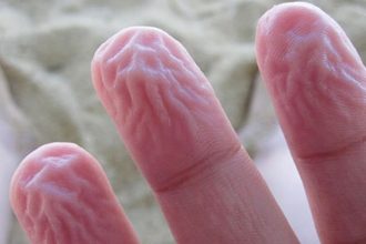 Γιατί έχουμε ζαρωμένα δάχτυλα μετά το μπάνιο;