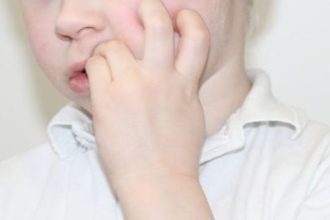 Παιδί: Πώς θα σταματήσει να τρώει τα νύχια του;