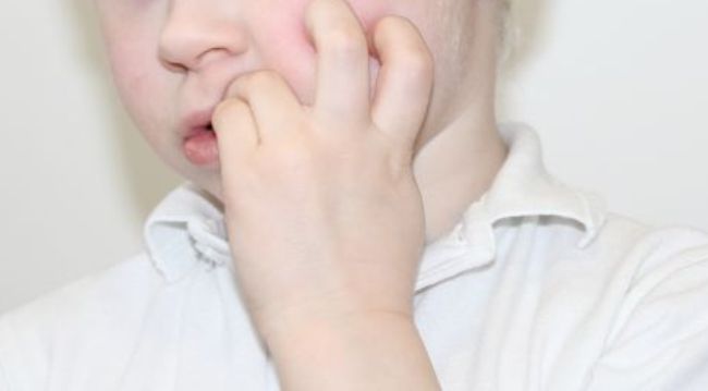 Παιδί: Πώς θα σταματήσει να τρώει τα νύχια του;