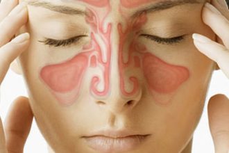 Ιγμορίτιδα: Πόσο διαρκεί – Τι να κάνετε για πονοκέφαλο και μπούκωμα