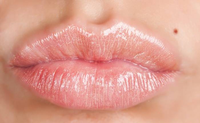 Πώς θα περιποιηθείτε σωστά τα ξηρά χείλη;