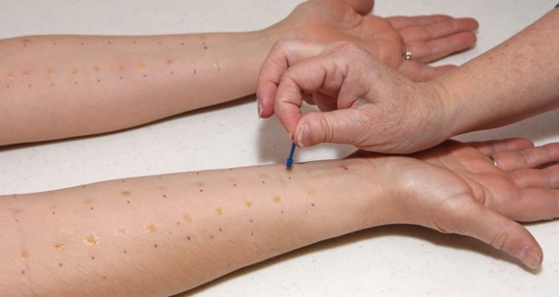 Συνεχίζονται οι δωρεάν Αλλεργιολογικοί έλεγχοι σε Αχαΐα και Αιτωλοακαρνανία