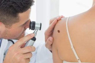 Βρετανία: Νέα θεραπεία για το μελάνωμα σκορπά αισιοδοξία