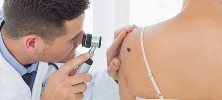 Βρετανία: Νέα θεραπεία για το μελάνωμα σκορπά αισιοδοξία