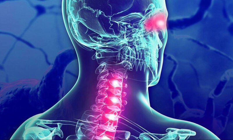 Πολλαπλή σκλήρυνση: Ο κίνδυνος από τα περιττά κιλά στην εφηβεία