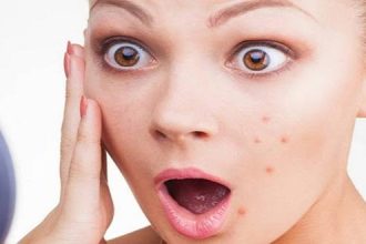 Δε φαντάζεσαι με τι υλικό μπορείς να εξαφανίσει ένα σπυράκι!