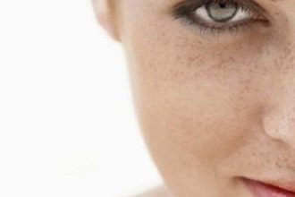 Πες αντίο στις πανάδες με… γιαούρτι και λεμόνι!