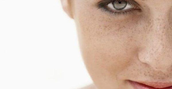 Πες αντίο στις πανάδες με… γιαούρτι και λεμόνι!