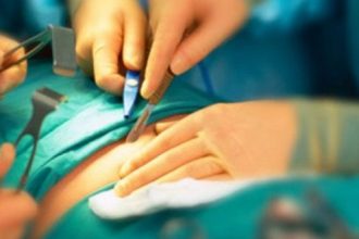 Απέτυχε η πρώτη μεταμόσχευση μήτρας στις ΗΠΑ - Τι πήγε στραβά