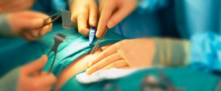 Απέτυχε η πρώτη μεταμόσχευση μήτρας στις ΗΠΑ - Τι πήγε στραβά