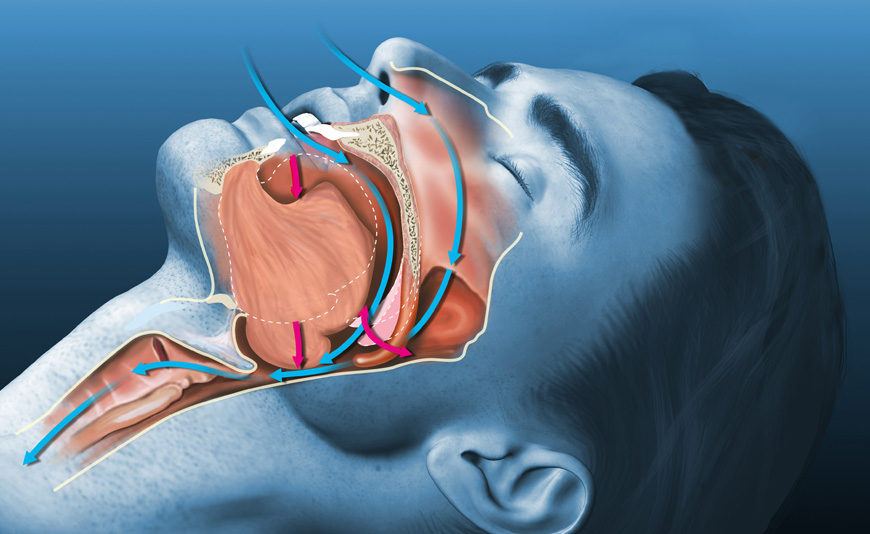 "Συνήθη προβλήματα Ωτορινολαρυγγολογίας και αντιμετώπισή τους"