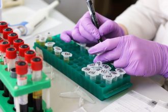 Επιστήμονες εντόπισαν πρωτεΐνη που ρυθμίζει την καύση του λίπους