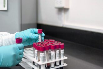 Μια απλή εξέταση αίματος θα μπορούσε να μεταμορφώσει τη θεραπεία για τον καρκίνο