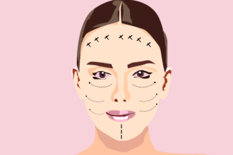 Από ποια ηλικία μπορείς να κάνεις botox προληπτικά