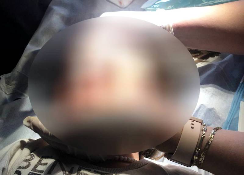 Δυτ. Ελλάδα: Κινδύνεψε η ζωή 4χρονης από άγρια επίθεση αδέσποτου σκύλου (ΦΩΤΟ)