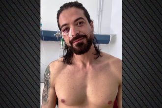 Αχαΐα: «Έχασα ό,τι πιο πολύτιμο είχα, νόμιζα ότι ήταν καπνογόνο» - Τα πρώτα λόγια του Άρη Μουγκοπέτρου από το νοσοκομείο μετά τον ακρωτηριασμό του (ΒΙΝΤΕΟ)