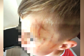 Ξυλοδαρμός 5χρονου σε νηπιαγωγείο του Αγρινίου: Έκτακτη σύσκεψη για τη διερεύνηση του περιστατικού - Ενημερώθηκαν οι Αρχές