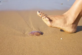 Τσιμπήματα τσούχτρας, εγκαύματα, καλοκαιρινοί ερεθισμοί: Πώς τα αντιμετωπίζουμε στις διακοπές
