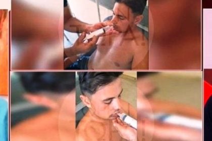 Σοκαριστικές εικόνες: Σιτίζεται με σύριγγα ο 18χρονος που ξυλοκοπήθηκε άγρια από ομάδα νεαρών στη Βόνιτσα
