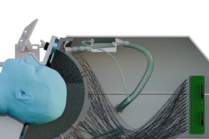 Πάρκινσον: Πρωτοποριακό κράνος υπερήχων μπορεί να θεραπεύσει τη νόσο χωρίς χειρουργική επέμβαση, υποστηρίζει μελέτη