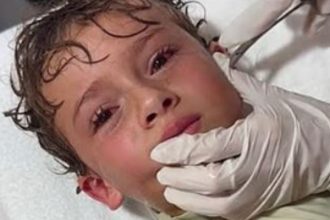 Βίντεο: Γιατρός αφαιρεί ζωντανό κάβουρα από το αυτί ενός μικρού αγοριού