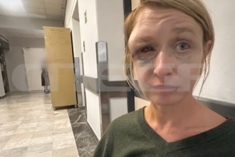 «Έχουμε σχέση αγάπης με τον σύντροφό μου» λέει η 40χρονη που ξυλοκοπήθηκε στο Κορωπί - Σοκάρει η εικόνα της μετά την κακοποίηση