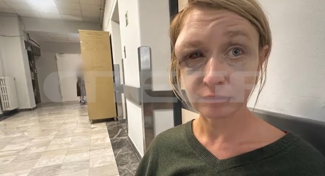 «Έχουμε σχέση αγάπης με τον σύντροφό μου» λέει η 40χρονη που ξυλοκοπήθηκε στο Κορωπί - Σοκάρει η εικόνα της μετά την κακοποίηση