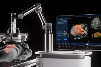 Πώς οι υπέρηχοι εγκαινιάζουν μια νέα εποχή στη θεραπεία του καρκίνου χωρίς χειρουργική επέμβαση