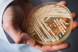 Candida auris: Όλα όσα θα πρέπει να γνωρίζετε για τον ανθεκτικό μύκητα