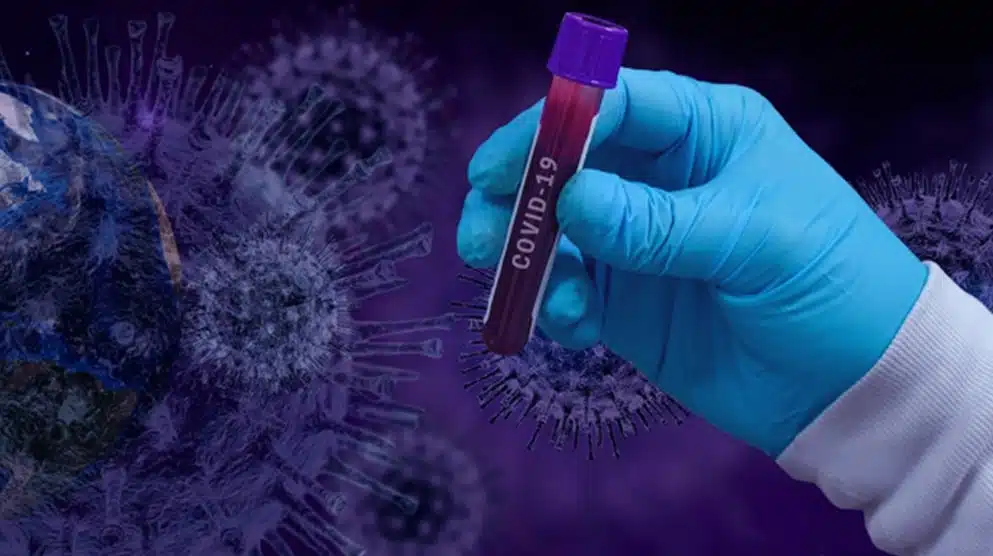 Πέντε θάνατοι από COVID-19 την τελευταία εβδομάδα