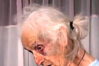 Δυτ. Ελλάδα: Ξυλοκόπησαν άγρια ηλικιωμένη για 100 ευρώ - Οργή για την άνανδρη επίθεση - «Τους παρακαλούσα, μη με χτυπάτε άλλο» (ΒΙΝΤΕΟ)