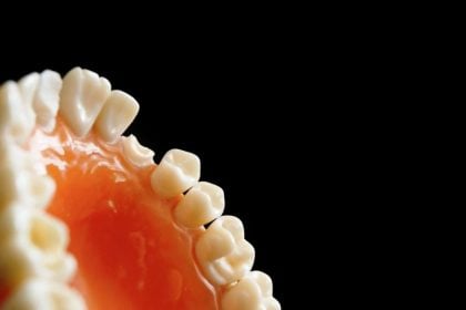 Επιστήμονες δημιούργησαν τζελ που αποκαθιστά το σμάλτο των δοντιών με φυσικό τρόπο