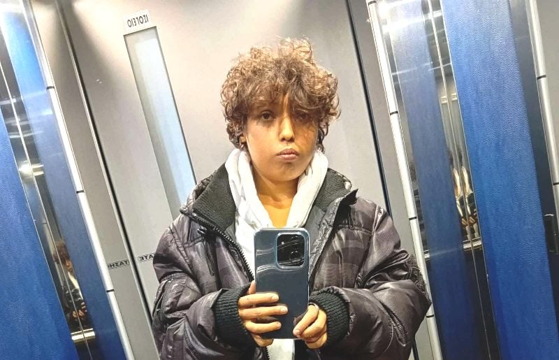 Εν αναμονή του πολύτιμου μοσχεύματος βρίσκεται ο 18χρονος Μάριος στο Τορίνο