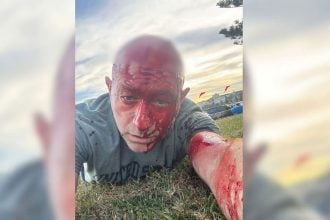 Επιζών της Χαμάς έζησε και το αιματοκύλισμα στο Σίδνεϊ