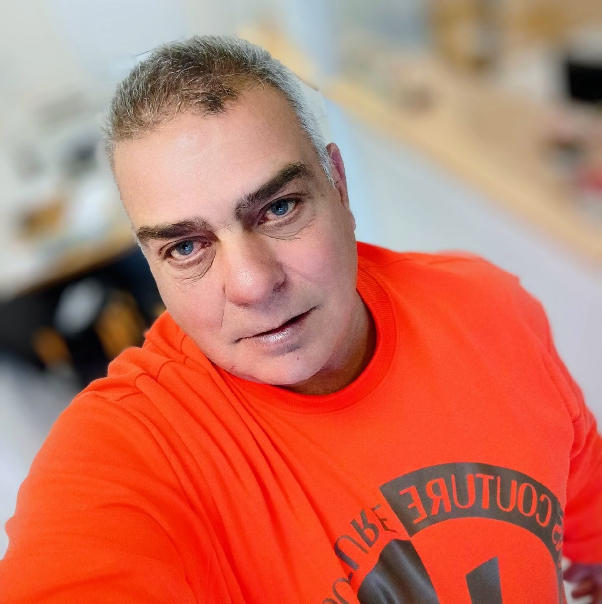 Πάτρα: Τραυματίστηκε σε τροχαίο ο Βασίλης Χρυσαΐτης