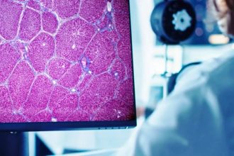 Εγκρίθηκε το πρώτο εργαλείο τεχνητής νοημοσύνης που επιταχύνει τις κλινικές δοκιμές φαρμάκων για ηπατική νόσο