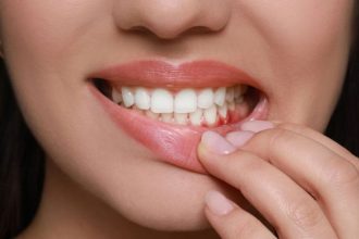 Η ουλίτιδα μπορεί να συνδέεται με αυξημένο κίνδυνο σοβαρών καρδιαγγειακών επεισοδίων