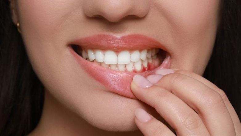 Η ουλίτιδα μπορεί να συνδέεται με αυξημένο κίνδυνο σοβαρών καρδιαγγειακών επεισοδίων