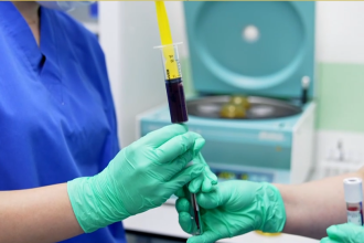 Οστεοπόρωση: Μία “σιωπηλή” επιδημία που επηρεάζει την ποιότητα ζωής