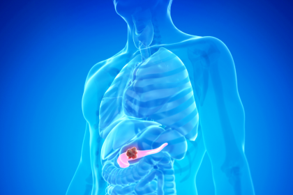 Καρκίνος του παγκρέατος: Πρωτοποριακή έρευνα αποκάλυψε γονιδιακά μοτίβα που σχετίζονται με τη νόσο