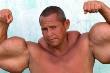 Πέθανε στα 55 του ο «Βραζιλιάνος Ποπάι»